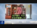 コロナワクチン後遺症　ベル麻痺罹患