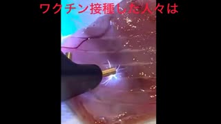 ホモと見るコロナワクチン寄生虫の殺し方