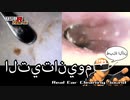 本物耳かきイヤースコープ/匠の技チタン