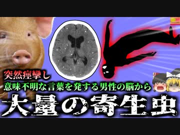 【2021年】意味不明な言葉を発し痙攣した男性 脳を調べるとそこには大量の白い影…『マサチューセッツ 有鈎の嚢虫感染症』【ゆっくり解説】