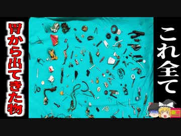 【2023年】腹痛を訴える男性 体内から150個以上の大量の鋭利な金属やアクセサリを摘出 彼はコッソリと何を食べていた？ 【ゆっくり解説】
