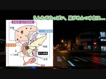 トイレチェックしてますか？その異常はガンかもしれない...