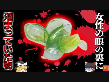 【2022年】「あれ…?コンタクト外したっけ？…まぁいっか」忘れて着けるの繰り返しで目の裏側に大量のコンタクト 両目の裏からソフトコンタクトが24枚も摘出された女性【ゆっくり解説】