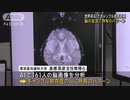 世界初AIでギャンブル依存判明　脳の血流に特有のパターン
