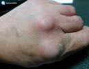 極真カラテ  ♪空手道男道♪ 空手ダコ集 part2