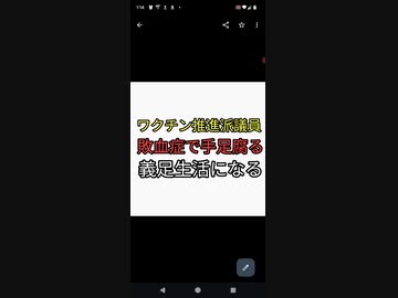 ワクチン推進派議員がワクチン血栓　敗血症で両手両足壊死　義足になる