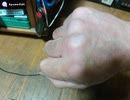 極真カラテ  ♪空手道男道♪ 空手拳ダコ画像集 part2