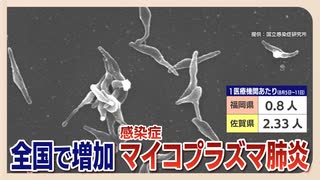 若い世代で「マイコプラズマ肺炎」増加中　感染から発症まで２～３週間の潜伏期間　呼吸器に持病ある人は重症化のおそれ