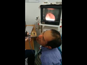 ホモと見る鼻から侵入したクソデカ蛭