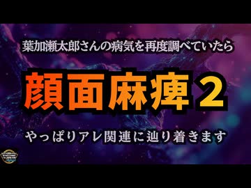 【顔面麻痺Part２】葉加瀬太郎さん、ジャスティン・ビーバーさんの病気を再度調べていたら・・・『顔面麻痺Part２』やっぱりアレ関連に辿り着きます【気になったニュース】