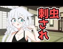 【ソフトウェアトーク劇場】ほぼ週刊劇場：IA「虫に刺された！！」