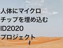人体にマイクロチップを埋め込むID2020プロジェクト