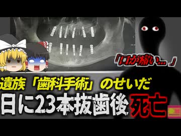 【2024年】『一日に23本歯を抜いた』一度に大量抜歯し、12本のインプラント埋入手術を受けた男性が死亡 (中国)【ゆっくり解説】