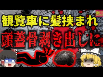 【2024年】『頭皮が全て剥がれた』お祭り中、観覧車に長い髪の毛を巻き込まれた少女 頭皮が丸ごと剥がれる重傷を負い危篤状態に…【ゆっくり解説】