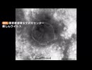 ベトナム・ハノイから帰国した10歳未満の男児「はしか」感染確認　福岡県内での感染確認は2021年以来