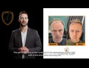 Capital Hair Restoration - Hair Transplant