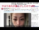やはりあれが底上げしたのではと　熊切あさ美　原因不明の病気「クインケ浮腫」告白、「まぶたが塞がるくらい腫れて人前に出られない顔に」　#毒ワクチン