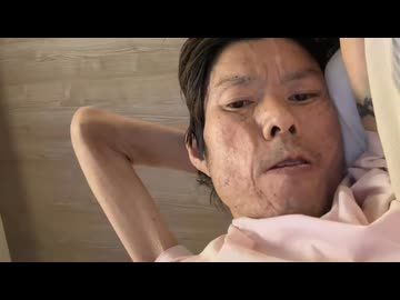 ホモと見る病気で完全に骨と皮だけになる余命僅かな配信者