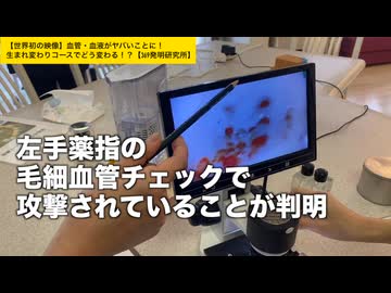 【世界初の映像】まぁーてる先生も驚き！血管・血液が危ない！生まれ変わりコースのエビデンス映像を公開【369発明研究所】