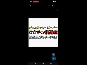 ジャスティン・ビーバー　ワクチン後遺症で顔面麻痺からのターボ老化で髪がハゲておじいさんみたいになり別人になってしまう