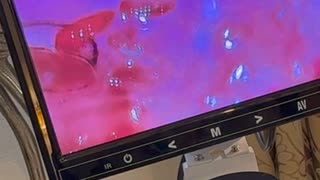※衝撃の映像「ハリガネ」その２　※左手の薬指の中