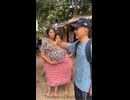 Wait Pregnant Conjoined Sisters