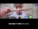 トム・ハビランド「2024年、301人のエンバーマーのうち250人が剖検で白色線維状血栓を観察した。その割合は83％と高く、2023年の73％を上回ると (2)