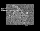流行が続く百日せき「集団の中で広がるという状況」福岡県は今年すでに８９５人　去年１年間の４倍に
