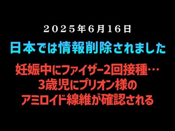 【日本では情報削除されました】◆妊娠中にファイザー2回接種…3歳児にプリオン様のアミロイド線維が確認される