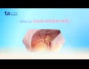 Cách điều trị gan nhiễm mỡ hiệu quả
