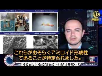 防腐処理業者の大多数が、死体の17～27％に白い繊維状の凝血塊が見られると報告しており