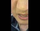 奥の手って、なんだ？イルミナティ？ディープステート？ロックフェラー財団？ビル＆メリンダゲイツ財団？13氏族？13支族？それとも、プロビデンスヤロウ！？