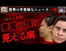 【悪魔顔症候群】全て事実、この世界にあふるる奇妙なニュース10選【ゆっくり解説】
