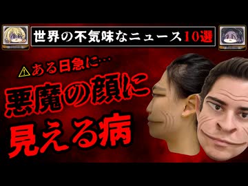 【悪魔顔症候群】全て事実、この世界にあふるる奇妙なニュース10選【ゆっくり解説】