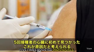 ゆっくり殺す計画的虐殺　耳を疑うような衝撃情報　コロナmRNAワクチンを5回も打った人の心臓に、何が起きていたのか——心臓がスパイクタンパクを作り続け、自己免疫が暴走し、瘢痕（はんこん）だらけの状態だ
