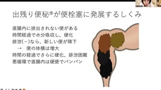 糞詰まり（便栓塞）について解説！