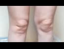 【*ringo*ちゃん ショートパンツ を披露する】膝に☺︎