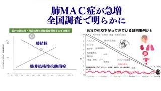 肺ＭＡＣ症が急増　全国調査で明らかに