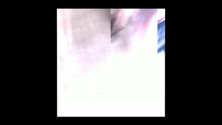 87