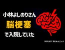 ◆小林よしのりさん脳梗塞で入院していた