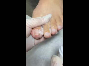 ホモと見る汚い爪が綺麗になるまで