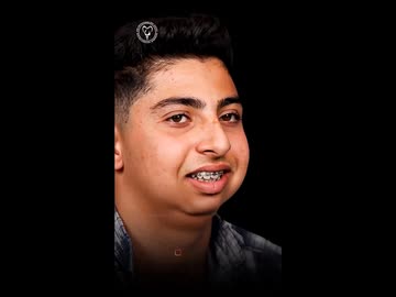 ホモと見る手術でイケメンになったチー牛