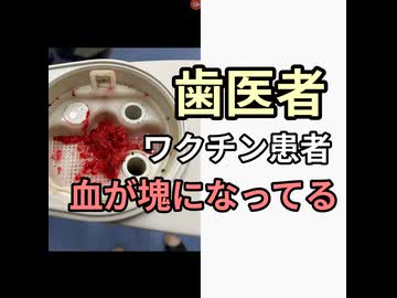 歯医者が患者の血をバキュームしたら血栓が血塊になり果物が潰れたようなものが出て歯科衛生士がビビる　ワクチン接種後からみんなこれ