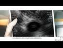 【夢青】#27 CASE-1 ⑱ あ圧が強い......