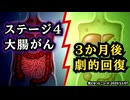 ◆ステージ4から奇跡の回復！？イベルメクチン＋駆虫薬で大腸がんが劇的改善【実際の症例報告】