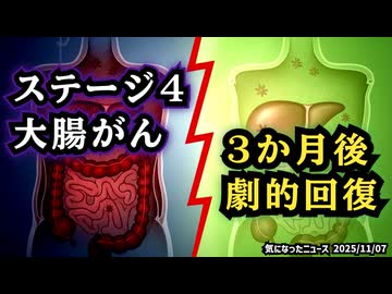 ◆ステージ4から奇跡の回復！？イベルメクチン＋駆虫薬で大腸がんが劇的改善【実際の症例報告】