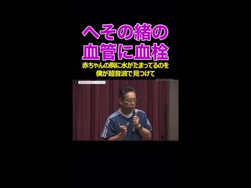 へその緒に血栓