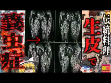 『伝統料理で全身に寄生虫』農村部の女性が全身症状で検査を受けると恐ろしいCT写真が…10歳から『豚の刺身』を食べていた結果…『雨崩村有鉤条虫感染症』【ゆっくり解説】