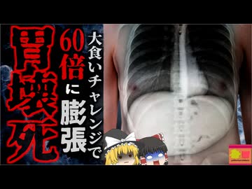 『食べ放題だし元取らないと…』→ビュッフェで無理やり10kg近く食べた男性 胃が通常の60倍に膨張し壊死し死亡…『長沙市食べ放題死亡事故』【ゆっくり解説】