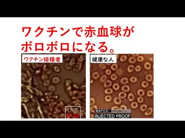 コロナワクチン接種者はどんな死に方をするのか？